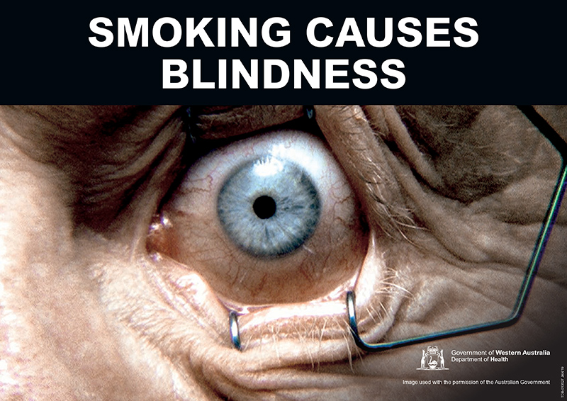 Banner: smoking causes blindness