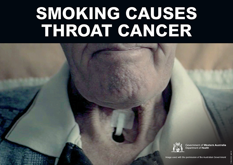 Banner: smoking causes throat cancer