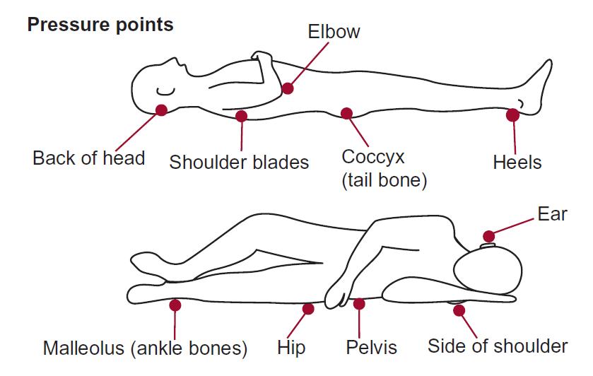 Pressure points on the human body when lying down